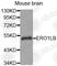 Endoplasmic Reticulum Oxidoreductase 1 Beta antibody, A3682, ABclonal Technology, Western Blot image 