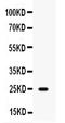 WAP Four-Disulfide Core Domain 2 antibody, PB9963, Boster Biological Technology, Western Blot image 