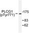 Phospholipase C Gamma 1 antibody, LS-C192194, Lifespan Biosciences, Western Blot image 
