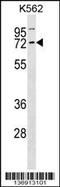 Cyclin K antibody, 58-912, ProSci, Western Blot image 