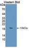 Interleukin 1 Family Member 10 antibody, LS-C375041, Lifespan Biosciences, Western Blot image 