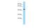 Ubiquitin-conjugating enzyme E2 Q2 antibody, PA5-45797, Invitrogen Antibodies, Western Blot image 