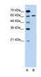 Apoptosis Inducing Factor Mitochondria Associated 1 antibody, orb327614, Biorbyt, Western Blot image 