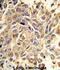 Receptor Like Tyrosine Kinase antibody, abx033608, Abbexa, Immunohistochemistry paraffin image 