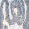 Eukaryotic Translation Initiation Factor 2 Alpha Kinase 2 antibody, 79-399, ProSci, Immunohistochemistry frozen image 