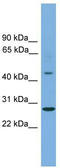 Zinc Finger Protein 514 antibody, TA345458, Origene, Western Blot image 