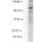 Gamma-Aminobutyric Acid Type A Receptor Delta Subunit antibody, 56462, QED Bioscience, Western Blot image 