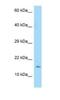 Interleukin 25 antibody, NBP1-98494, Novus Biologicals, Western Blot image 