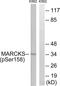 Myristoylated Alanine Rich Protein Kinase C Substrate antibody, LS-C117407, Lifespan Biosciences, Western Blot image 