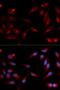 ADAM Metallopeptidase Domain 9 antibody, LS-C334028, Lifespan Biosciences, Immunofluorescence image 