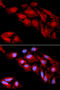 Catenin Delta 1 antibody, 16-592, ProSci, Immunofluorescence image 