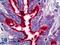 Mucin 1, Cell Surface Associated antibody, LS-B6600, Lifespan Biosciences, Immunohistochemistry paraffin image 