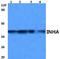 Inhibin Subunit Alpha antibody, A02413, Boster Biological Technology, Western Blot image 