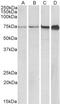 Dipeptidyl transferase antibody, 43-379, ProSci, Western Blot image 