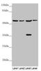 Solute Carrier Family 1 Member 5 antibody, LS-C676498, Lifespan Biosciences, Western Blot image 