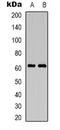 CD19 antibody, LS-C413347, Lifespan Biosciences, Western Blot image 