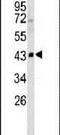 Sphingomyelin Phosphodiesterase 2 antibody, PA5-24614, Invitrogen Antibodies, Western Blot image 