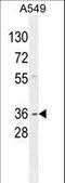 G Protein Subunit Alpha Transducin 3 antibody, LS-C166554, Lifespan Biosciences, Western Blot image 