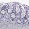 Pannexin 2 antibody, NBP1-92242, Novus Biologicals, Immunohistochemistry paraffin image 