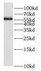 Fukutin antibody, FNab03240, FineTest, Western Blot image 