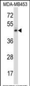 Nuclear Receptor Subfamily 2 Group F Member 1 antibody, PA5-35142, Invitrogen Antibodies, Western Blot image 