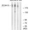 Zinc Finger CCCH-Type Containing 13 antibody, A11022, Boster Biological Technology, Western Blot image 