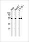 TERF2 Interacting Protein antibody, PA5-35137, Invitrogen Antibodies, Western Blot image 