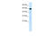 Mucolipin 1 antibody, 28-268, ProSci, Western Blot image 