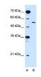 Solute Carrier Family 2 Member 10 antibody, orb325122, Biorbyt, Western Blot image 