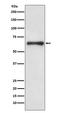 Cell Division Cycle 6 antibody, M01355, Boster Biological Technology, Western Blot image 