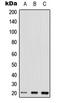 Rho-related GTP-binding protein RhoQ antibody, LS-C353816, Lifespan Biosciences, Western Blot image 