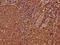 Immunoglobulin Heavy Constant Alpha 2 (A2m Marker) antibody, LS-C680637, Lifespan Biosciences, Immunohistochemistry paraffin image 