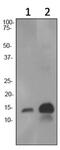 Hemoglobin Subunit Alpha 2 antibody, ab92492, Abcam, Western Blot image 