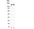 Glutamate Ionotropic Receptor NMDA Type Subunit 2A antibody, R30238, NSJ Bioreagents, Western Blot image 