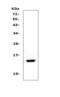 Cystatin A antibody, LS-C313223, Lifespan Biosciences, Western Blot image 