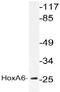 Homeobox A6 antibody, AP21069PU-N, Origene, Western Blot image 