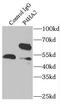 Prolyl 4-Hydroxylase Subunit Alpha 2 antibody, FNab06080, FineTest, Immunoprecipitation image 