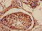 NUOMS antibody, LS-C673035, Lifespan Biosciences, Immunohistochemistry paraffin image 