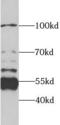 Serine Palmitoyltransferase Long Chain Base Subunit 1 antibody, FNab08206, FineTest, Western Blot image 