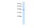 Zinc Finger MYM-Type Containing 5 antibody, PA5-40888, Invitrogen Antibodies, Western Blot image 