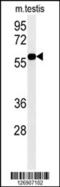 Dyskerin Pseudouridine Synthase 1 antibody, 61-945, ProSci, Western Blot image 