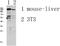 Glutamate Ionotropic Receptor NMDA Type Subunit 2D antibody, STJ99647, St John