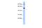 Dynein Axonemal Assembly Factor 1 antibody, PA5-44032, Invitrogen Antibodies, Western Blot image 