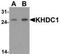 KH Domain Containing 1 antibody, TA320032, Origene, Western Blot image 