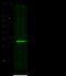SULT1A1 antibody, 11658-MM03, Sino Biological, Western Blot image 