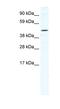 Tetratricopeptide Repeat Domain 19 antibody, NBP1-91534, Novus Biologicals, Western Blot image 