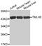 Trimethyllysine Hydroxylase, Epsilon antibody, MBS126927, MyBioSource, Western Blot image 