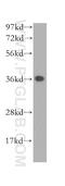 Ankyrin repeat domain-containing protein 1 antibody, 11427-1-AP, Proteintech Group, Western Blot image 