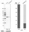 Glutamic-Oxaloacetic Transaminase 2 antibody, NBP1-81565, Novus Biologicals, Western Blot image 
