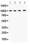 Nuclear Factor, Erythroid 2 Like 2 antibody, PB9290, Boster Biological Technology, Western Blot image 